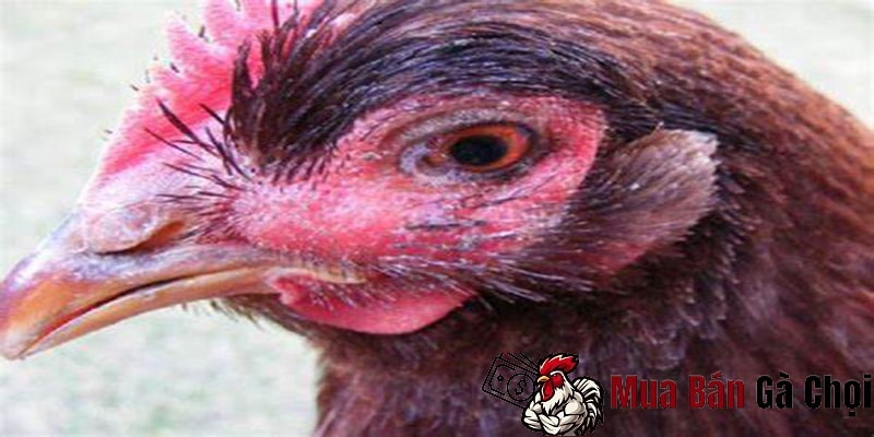 Bệnh kén mép là gì